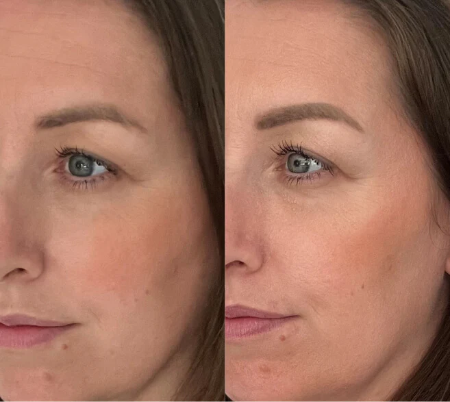 Customer result