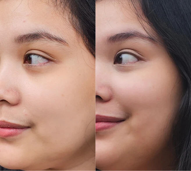 Customer result