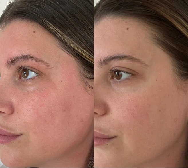 Customer result