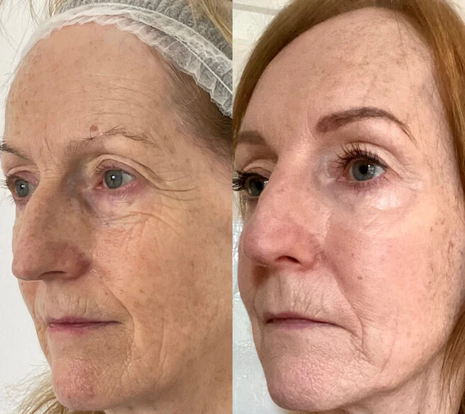 Customer result