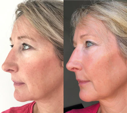 Customer result