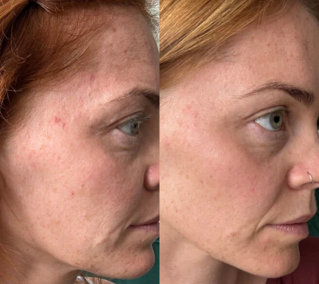 Customer result