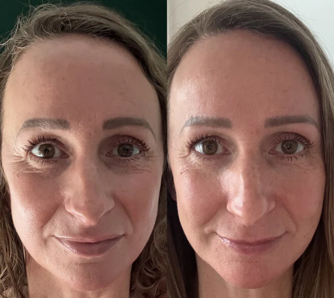 Customer result