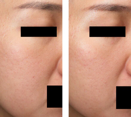 Customer result