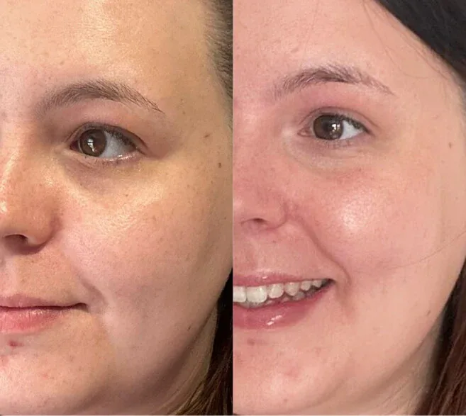 Customer result