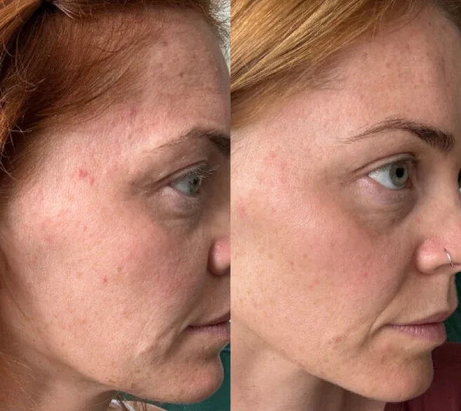Customer result